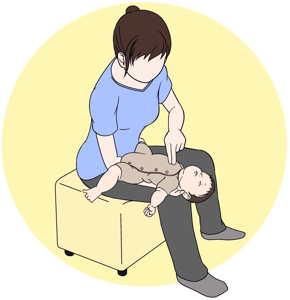自分の片腕に乳児の背中を乗せ、手のひらで乳児の後頭部をしっかり支えながら、頭側を下げるように仰向けの姿勢にする