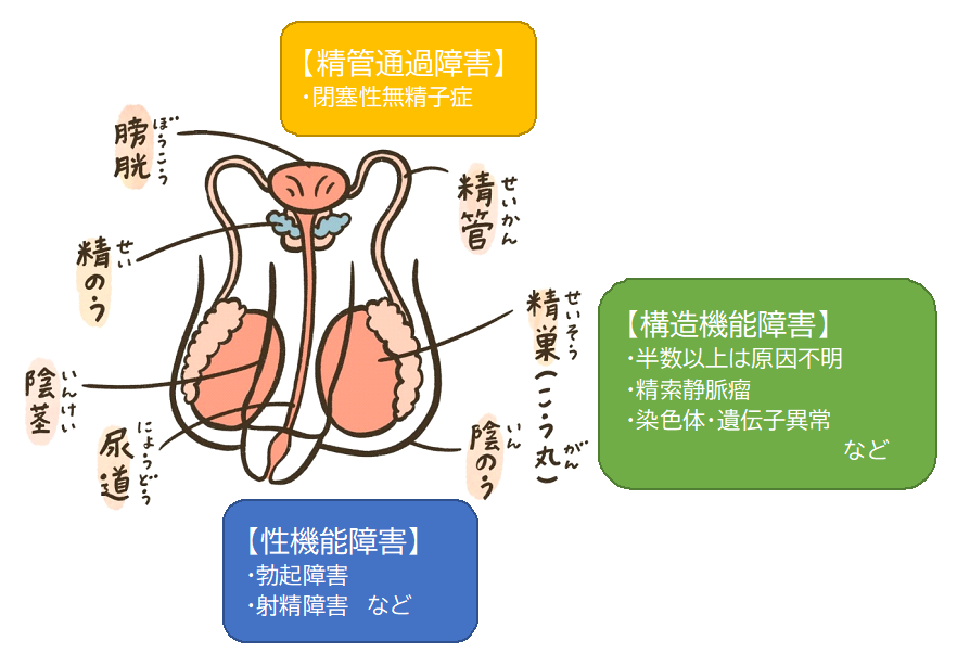 男性不妊の原因