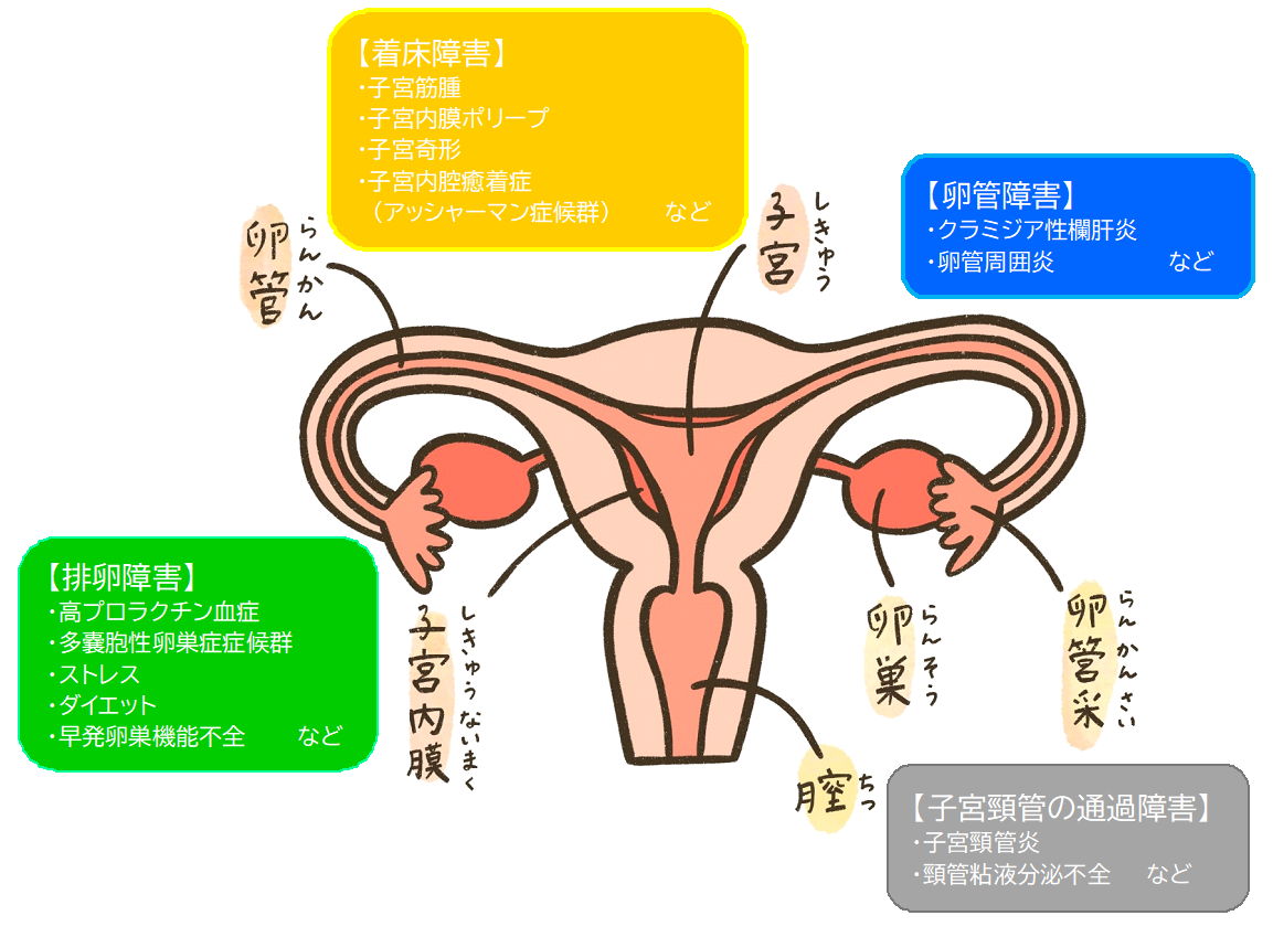 女性の不妊の原因